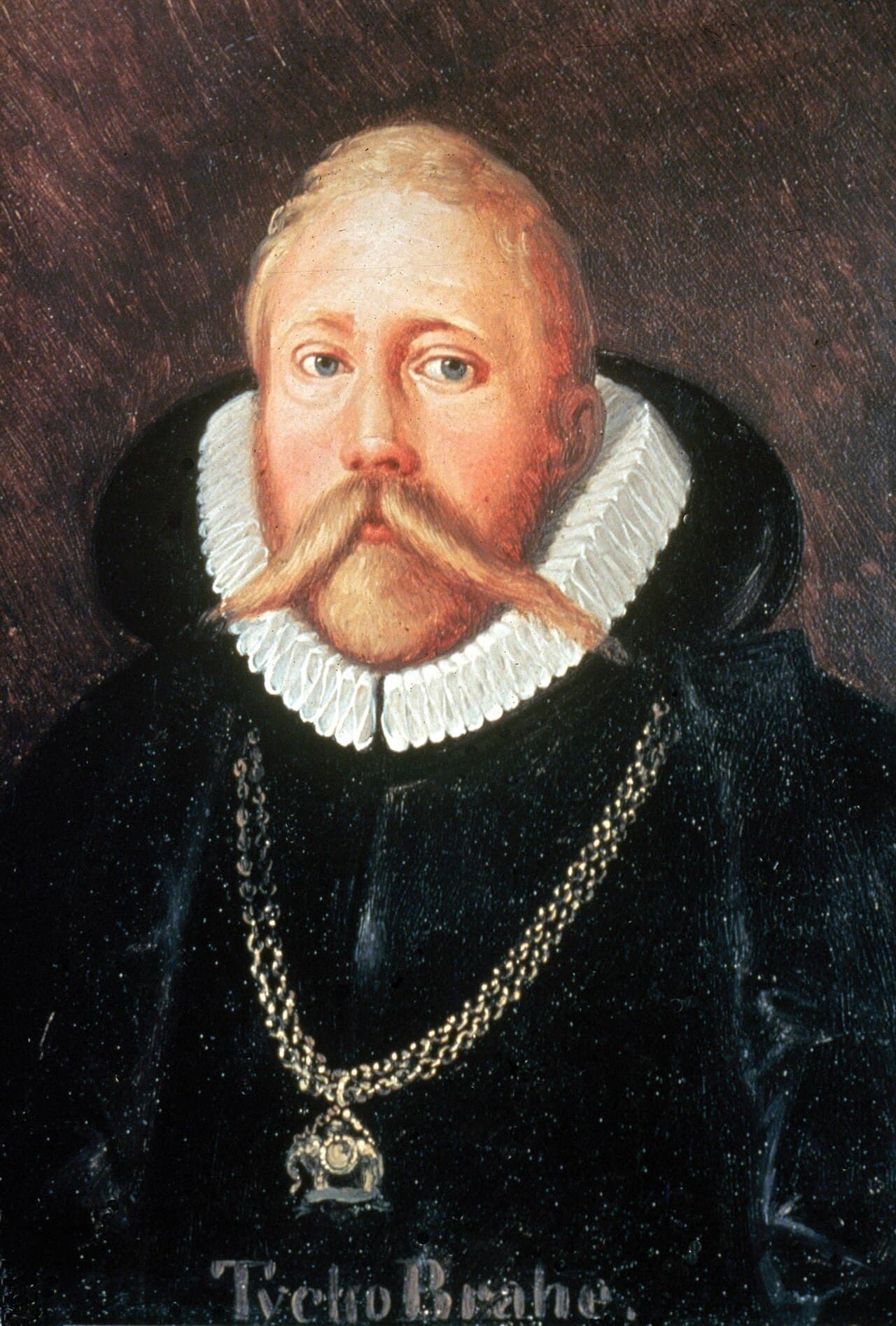 Tycho Brahe in a 17th-century portrait. The bridge of the nose is the metal prosthetic that replaced the original after the 1566 duel.