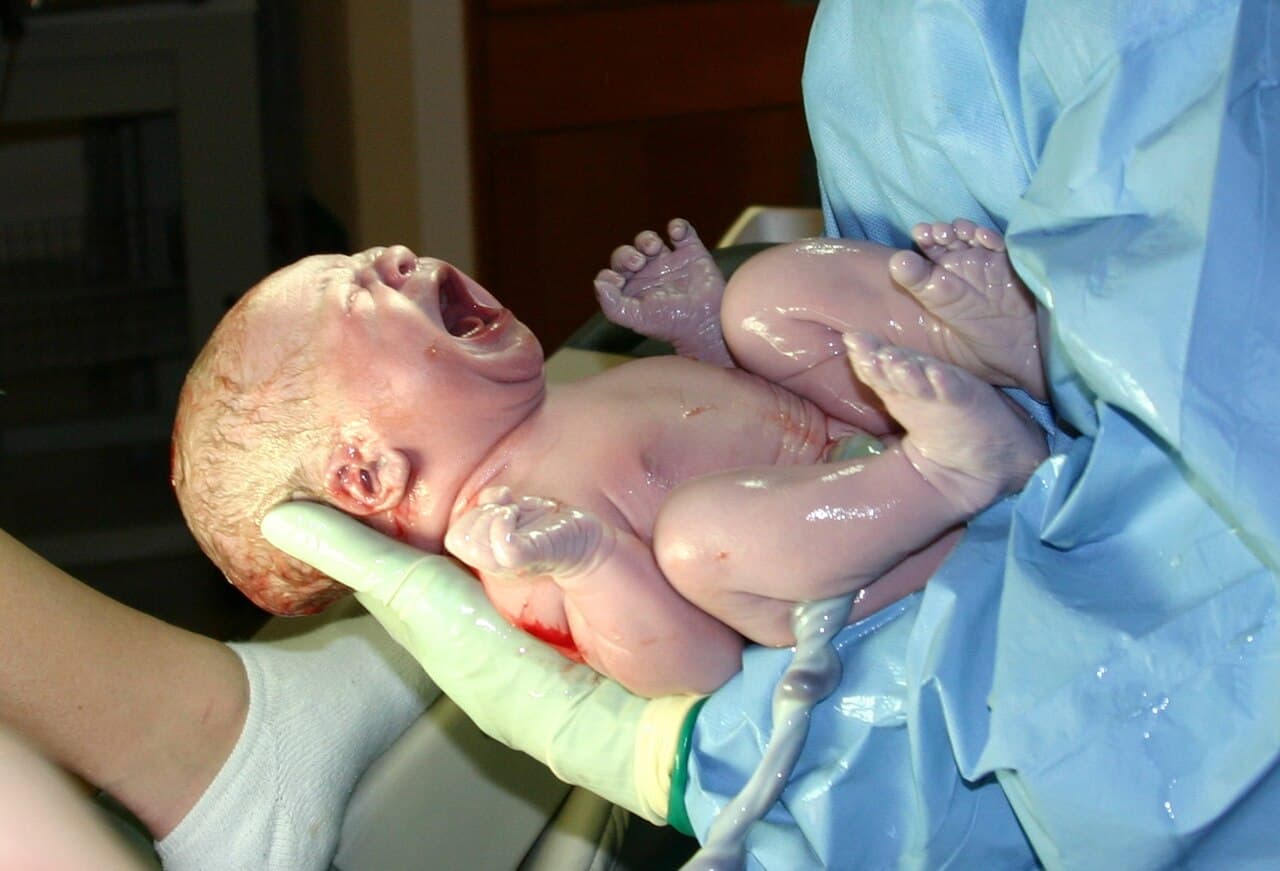 Tearful emotional crying begins around 2-3 months. Newborns cry from birth but do not produce significant tears for the first weeks.