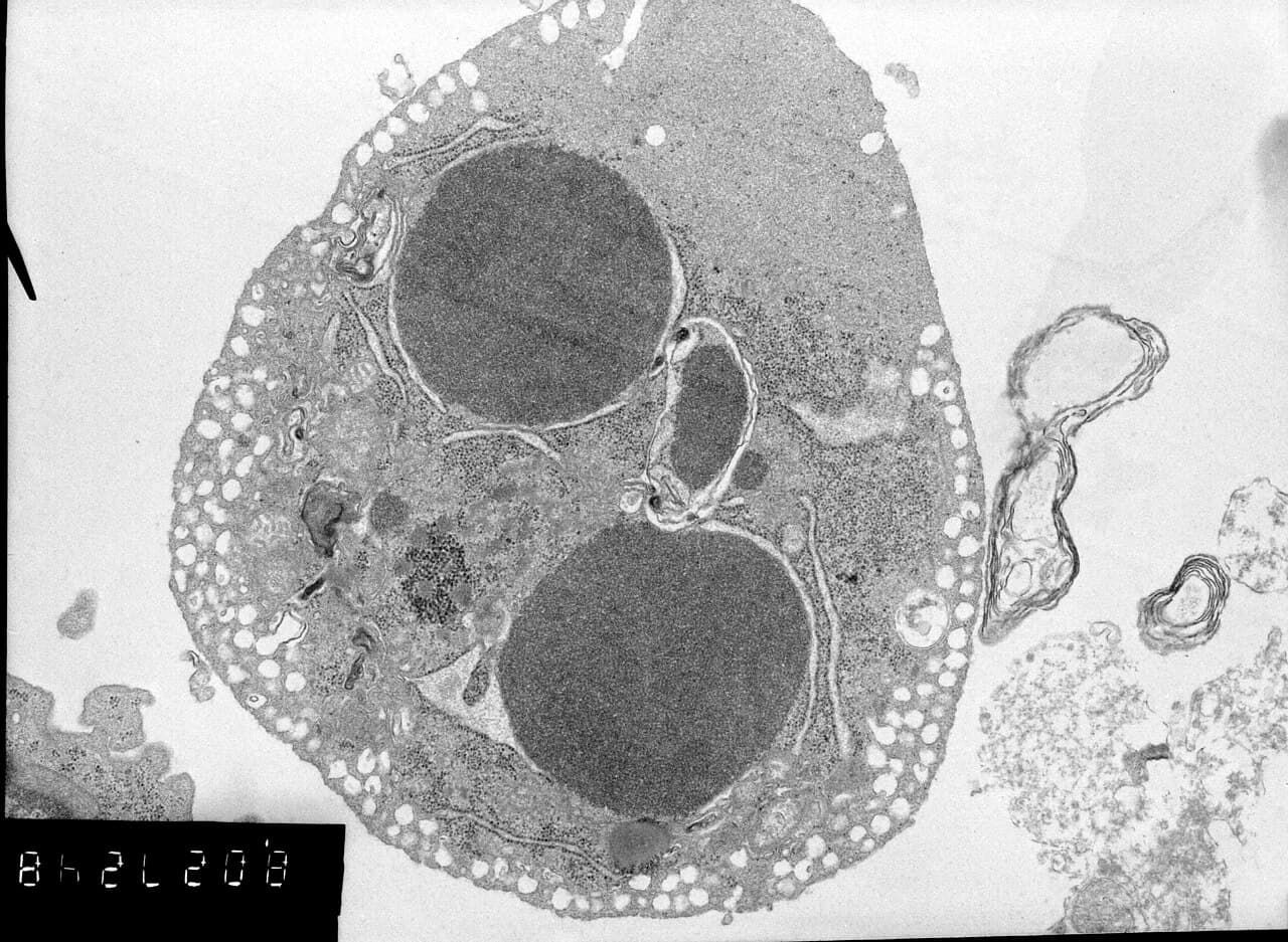 Apoptosis: programmed cell death. The elephant's TP53 dosage tilts the response to DNA damage in this direction, rather than the riskier path of repair.