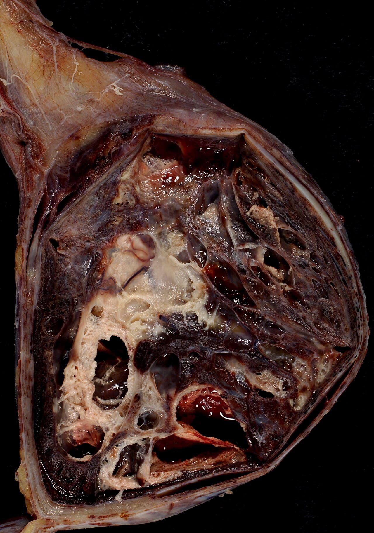 Syncytiotrophoblast — a single fused cell with many nuclei, lining the placenta. The fusion is mediated by syncytin, a captured viral protein.