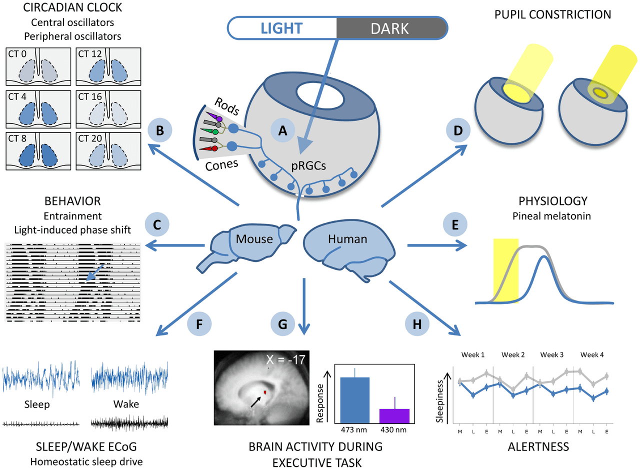 Functional imaging of the dreaming brain. Visual association cortex and amygdala are highly active; the dorsolateral prefrontal cortex — responsible for logical monitoring — is suppressed.