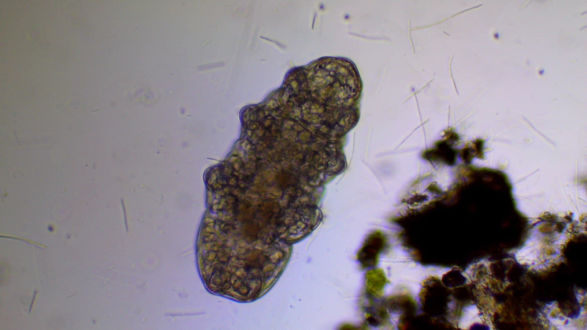 The tardigrade