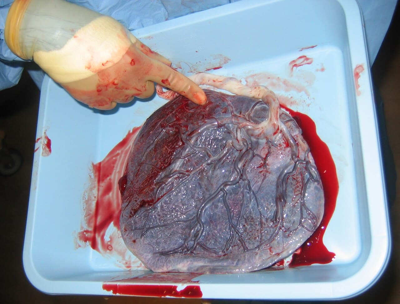 A term human placenta. The tissue layer that interfaces with the maternal blood supply is built from cells fused by a protein of retroviral origin.